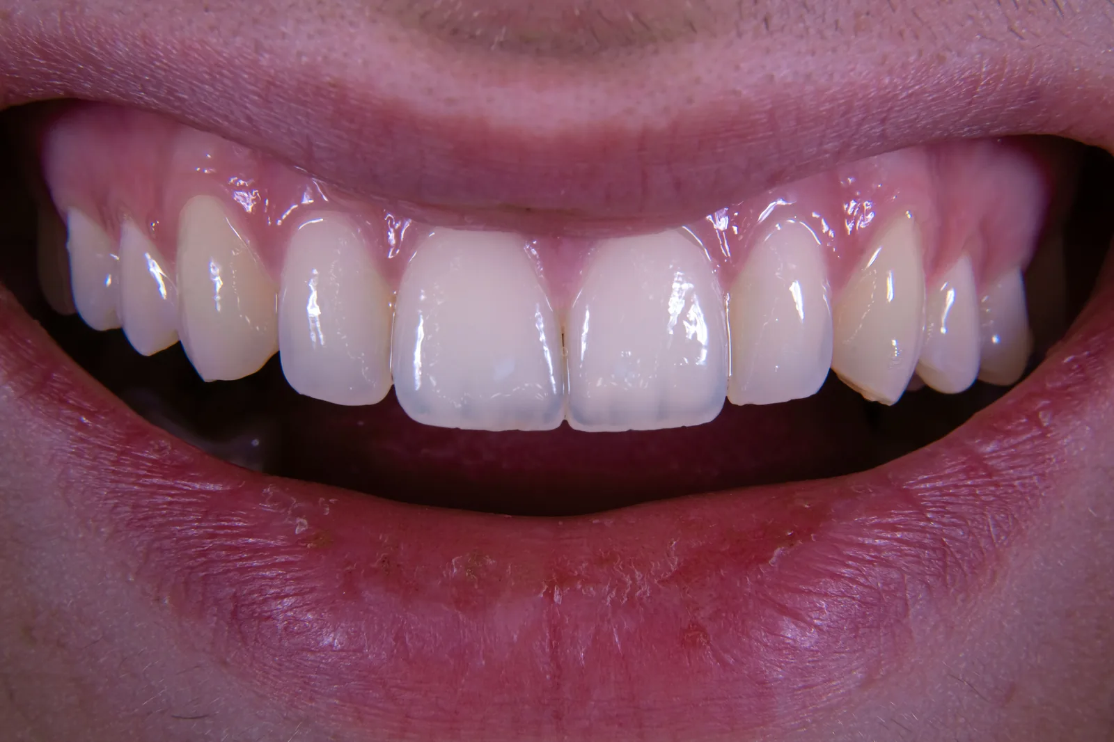 Cosmetic Dentistry